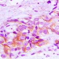 ATP1B1 Antibody