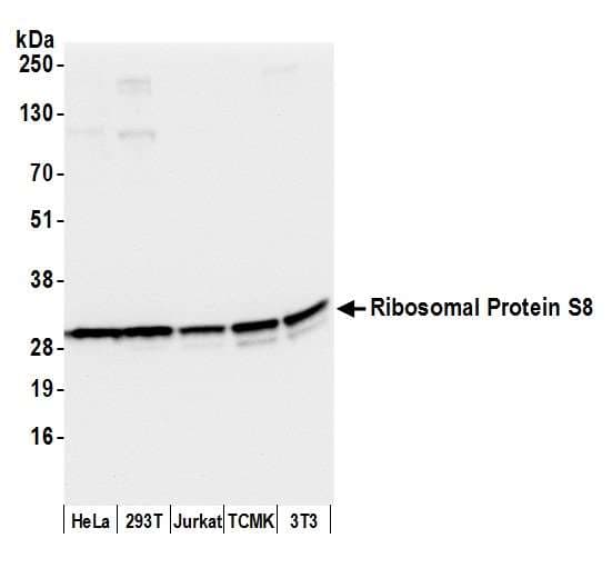 RPS8 / Ribosomal Protein S8 Antibody (aa158-208)