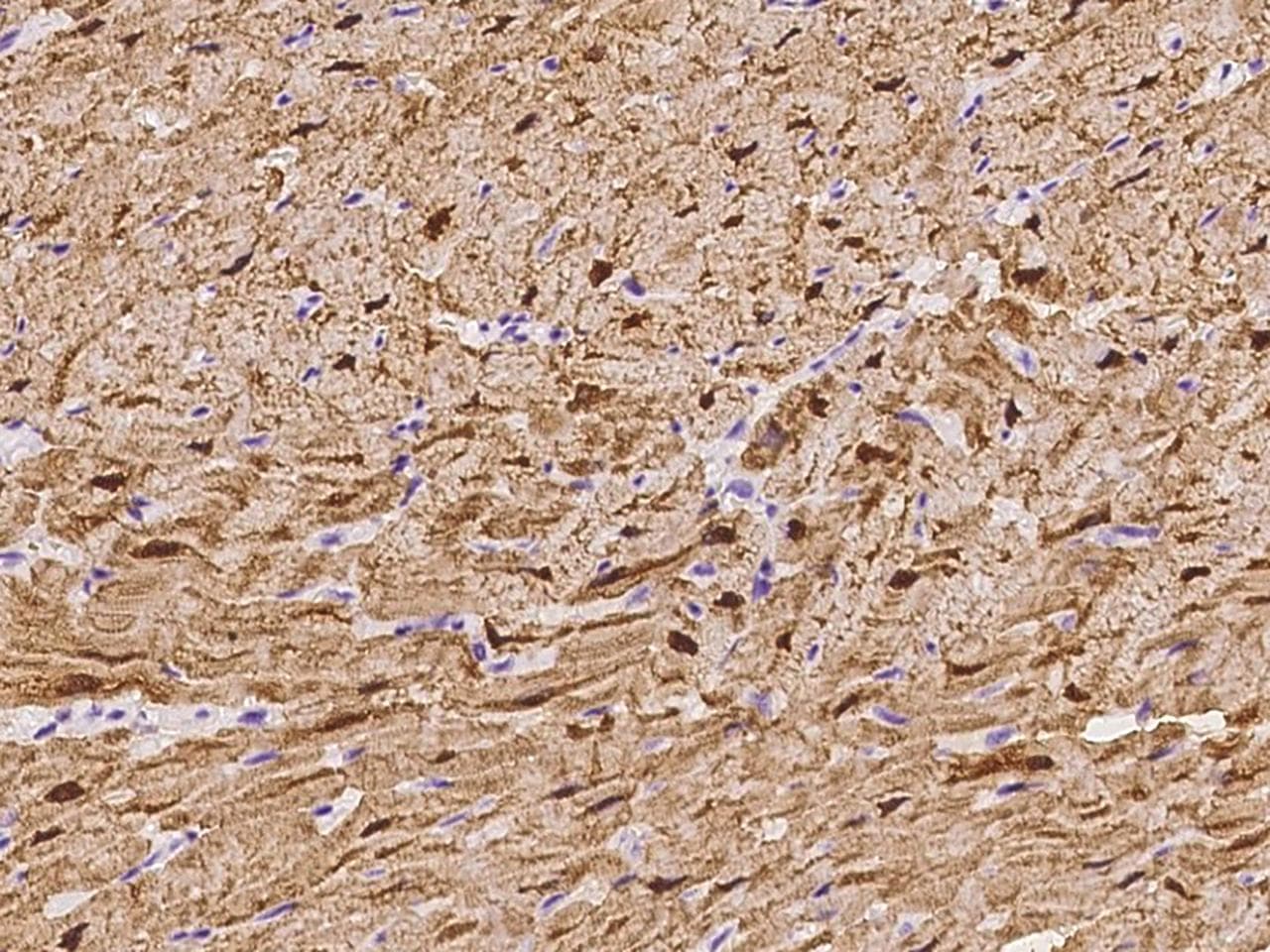 Polyclonal Rabbit anti-Human MB / Myoglobin Antibody (IHC)