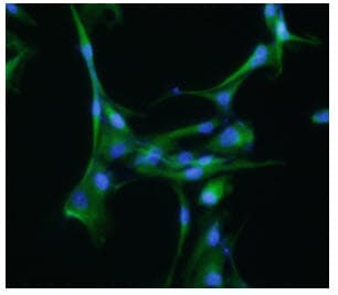 TUBB3 / Tubulin Beta 3 Antibody (clone AT2F5)