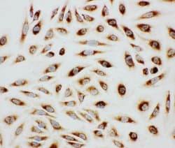 Polyclonal Rabbit anti-Human PXN / Paxillin Antibody (aa456-472, IHC, WB)