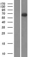 Complement C9 Protein (Over-Expression Lysate Myc-DDK (Flag))