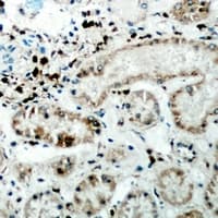 Polyclonal Rabbit anti-Human CER1 Antibody (Internal, IHC, WB)