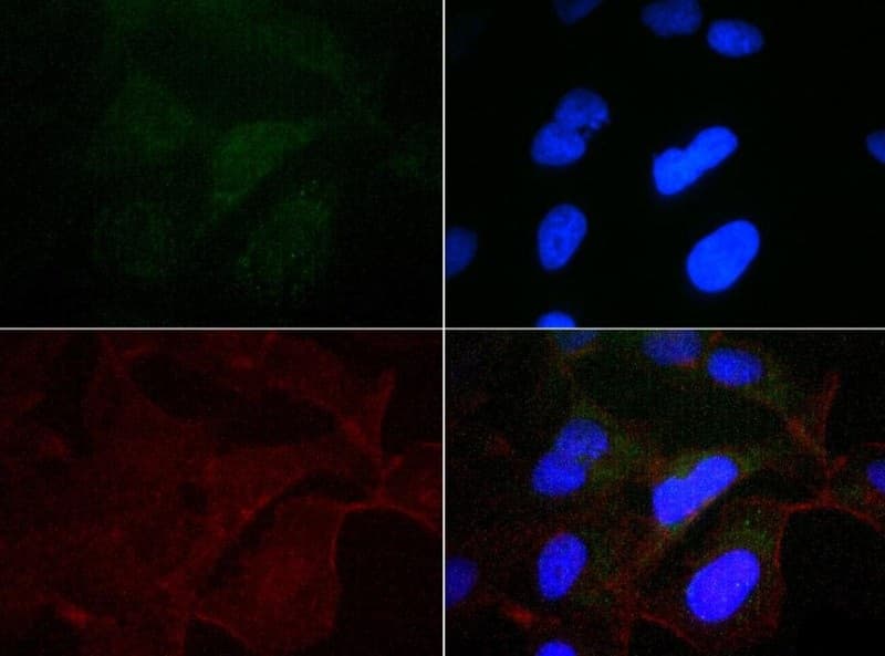 CANX / Calnexin Antibody