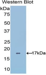 ADAMTS4 Antibody (aa437-575)