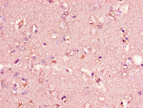 CIDEA / CIDE-A Antibody