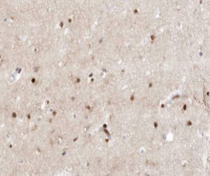 ZIC / ZIC1 Antibody