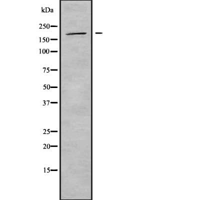 ADGRB3 / BAI3 Antibody