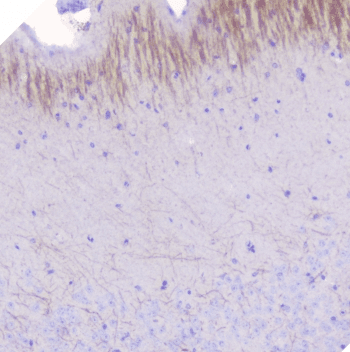Polyclonal Rabbit anti-Human MOG Antibody (IHC, WB)