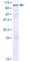 Human TIAM2 Protein (Recombinant GST)
