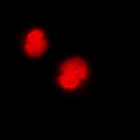 CAMK4 / CaMK IV Antibody (Internal)