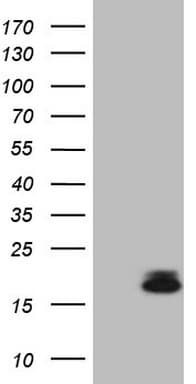 PLA2G2A / SPLA2 Antibody (aa21-144, clone OTI1C2)