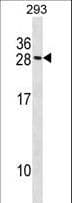 MARCKSL1 Antibody (aa132-160)