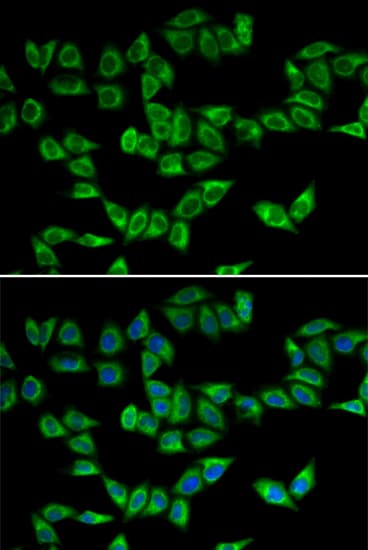 IHC-plus™ PRDX5 / Peroxiredoxin 5 Antibody