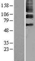 PPARG / PPAR Gamma Protein (Over-Expression Lysate Myc-DDK (Flag))