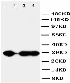 Polyclonal Rabbit anti-Human CA1 / Carbonic Anhydrase I Antibody (aa51-68, WB)