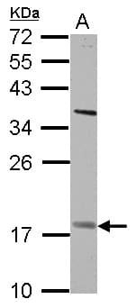 Polyclonal Rabbit anti-Human PNPLA4 Antibody (IHC, WB)