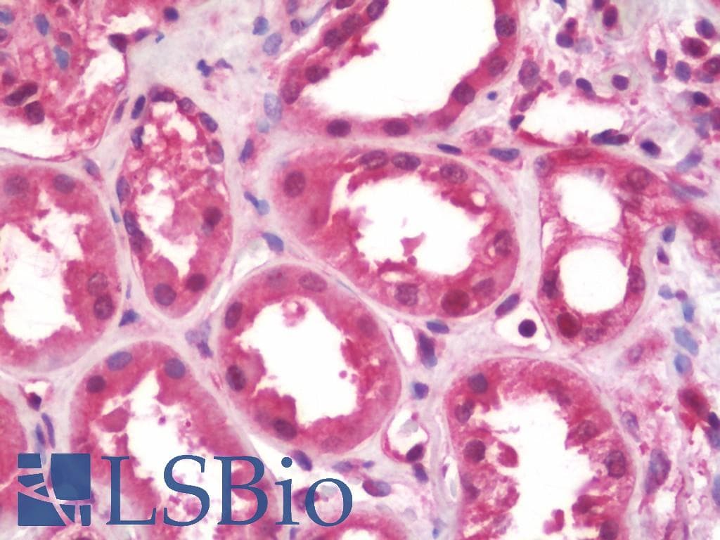 IHC-plus™ Polyclonal Rabbit anti-Human PICALM / CALM Antibody (IHC, WB)