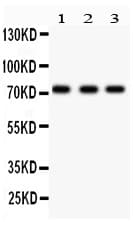Polyclonal Rabbit anti-Human TP73 / p73 Antibody (aa1-198, IHC, WB)