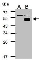 IHC-plus™ NR2F1 / Coup-TF Antibody (aa1-44)
