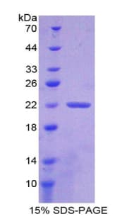 Human CLIC1 / NCC27 Protein (Recombinant His-T7)