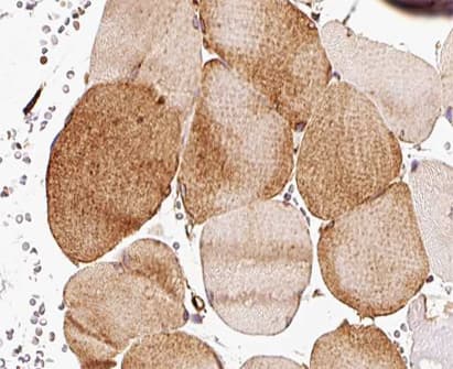 Polyclonal Rabbit anti-Human CDKN2C / p18 INK4c Antibody (IHC, IF, WB)