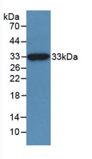 Beta-N-Acetylglucosaminidase Antibody (aa6-240)