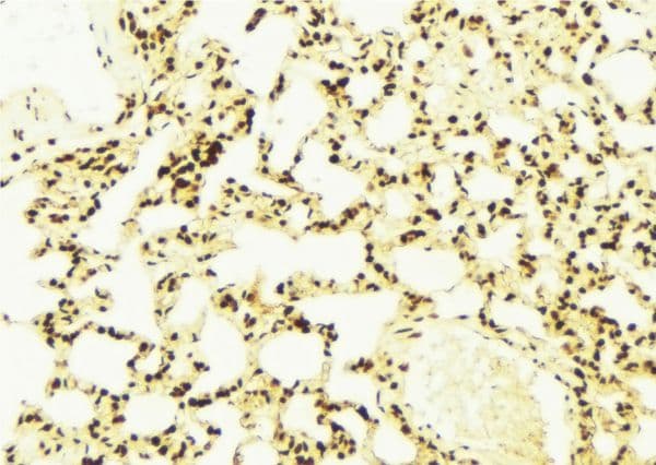 ATXN7 / SCA7 / Ataxin-7 Antibody