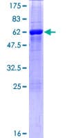 Human UP2 / UPP2 Protein (Recombinant GST)