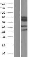 CES2 / Esterase Protein (Over-Expression Lysate Myc-DDK (Flag))