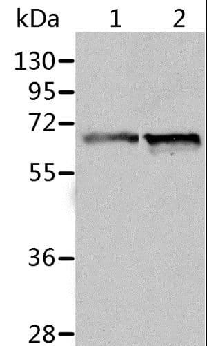 Polyclonal Rabbit anti-Human P5CDH / ALDH4A1 Antibody (IHC, WB)