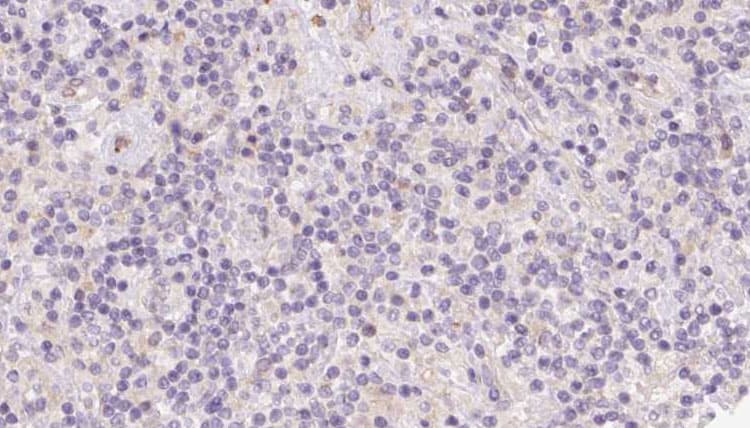 Polyclonal Rabbit anti-Human BCO2 / BCDO2 Antibody (IHC, IF, WB)