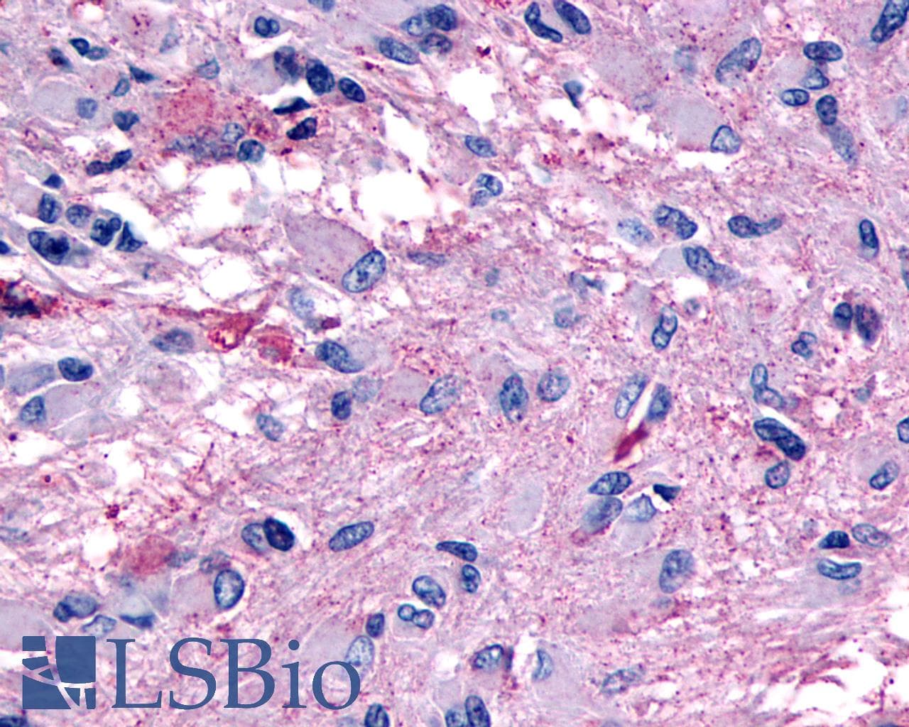 PathPlus™ GPR139 Antibody (Transmembrane Domain)