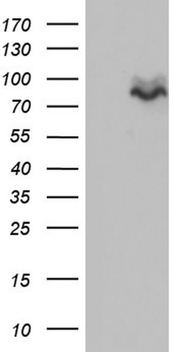 MDM2 Antibody (aa119-438, clone OTI20D1)