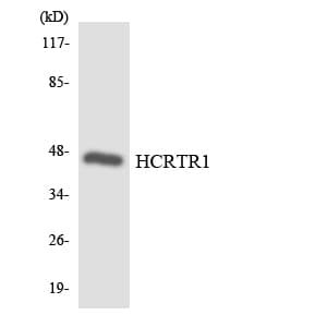 Polyclonal Rabbit anti-Human OX1R / Orexin Receptor 1 Antibody (aa221-270, WB)