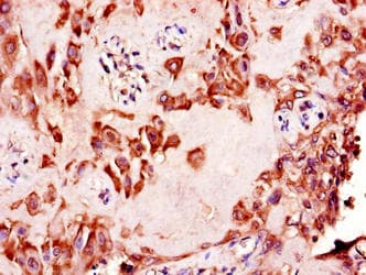 Polyclonal Rabbit anti-Human NAALADL2 Antibody (WB)