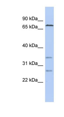 CEL / Carboxyl Ester Lipase Antibody (C-Terminus)