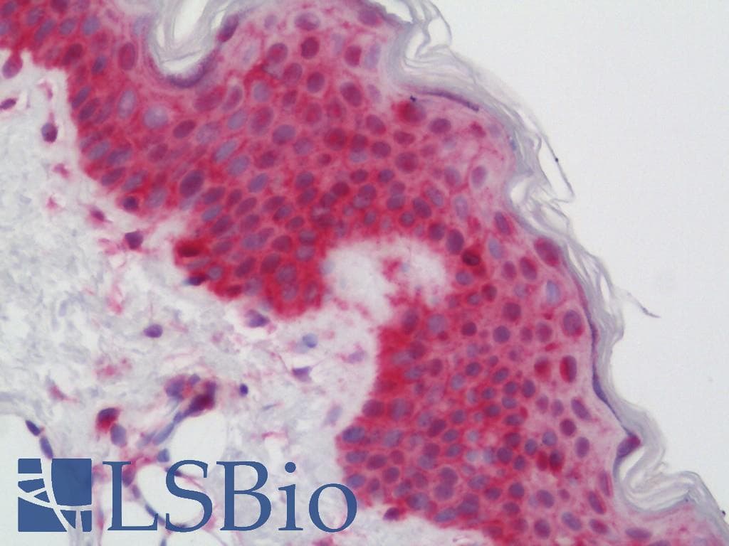IHC-plus™ Polyclonal Rabbit anti-Human CAMKK2 Antibody (aa374-423, IHC, WB)