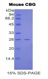 Mouse SERPINA6 / CBG Protein (Recombinant His)