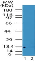 ACP1 / Acid Phosphatase Antibody (aa40-80)