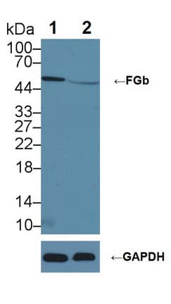 FGB / Fibrinogen Beta Chain Antibody (aa55-118)
