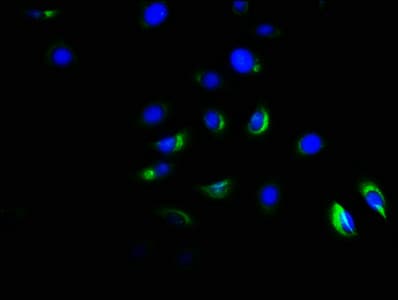 Polyclonal Rabbit anti-Human ACVR1B / ALK4 Antibody