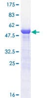 Human PSME1 Protein (Recombinant GST)