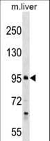 PROSER1 / C13orf23 Antibody (aa128-156)