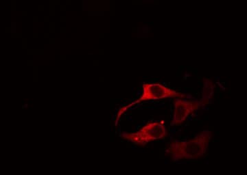Polyclonal Rabbit anti-Human ATP1A1 Antibody (phospho-Ser16, IHC, IF, WB)