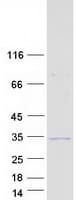 Human SOX14 Protein (Recombinant Myc-DDK (Flag))
