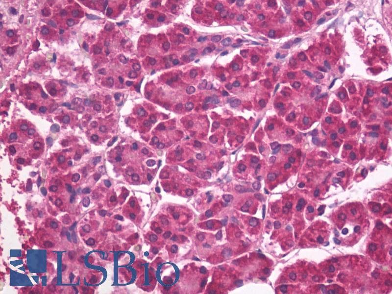 IHC-plus™ FLCN / Folliculin Antibody (N-Terminus)