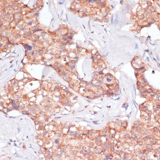Polyclonal Rabbit anti-Human TIMM8B Antibody (IHC, IF)