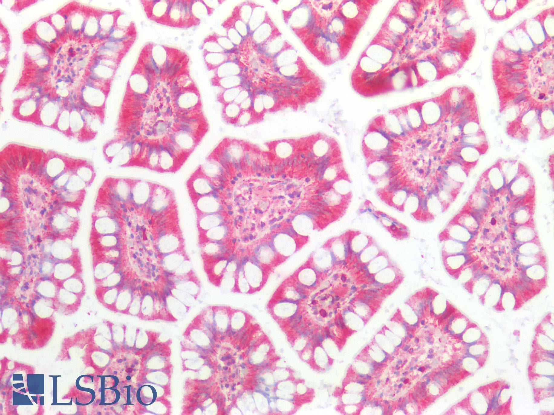 PathPlus™ LDLR / LDL Receptor Antibody (aa810-860)