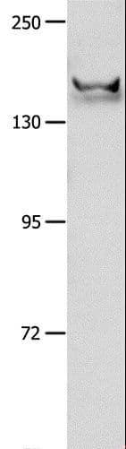 GRIN2B / NMDAR2B / NR2B Antibody